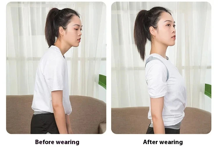 2026 New Smart Posture Corrector Rechargeable Back Brace 8 Shape Vibration Reminder 400mAh Battery for Work Study Office Home